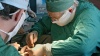 Екатеринбургские врачи пришили мужчине отрезанную голову