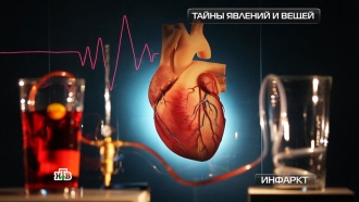 Технологии против инфаркта: современные способы борьбы со смертельной болезнью