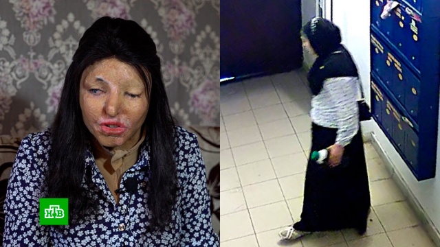 Полиция нашла жительницу Уфы, облившую подругу кислотой.Азербайджан, жестокость, нападения, расследование, убийства и покушения, Уфа.НТВ.Ru: новости, видео, программы телеканала НТВ