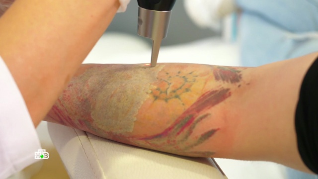 Боевой раскрас: как татуировки отражаются на здоровье.здоровье, татуировки.НТВ.Ru: новости, видео, программы телеканала НТВ
