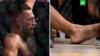 Макгрегор сломал ногу на турнире UFC и проиграл американцу Порье