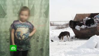 «Они с нее скальп сняли»: под Челябинском бродячие собаки набросились на 11-летнюю школьницу