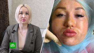 Женщина 2 года пытается наказать кемеровского косметолога за испорченную внешность