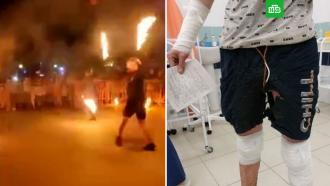 Зрители получили ожоги во время фаер-шоу под Воронежем