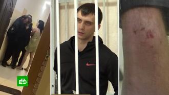 В Белгороде вынесли приговор мужчине, покусавшему участкового
