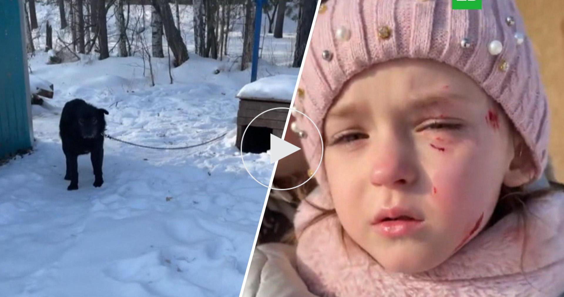 Сторожевой пес искусал ребенка в питомнике в Екатеринбурге // НТВ.Ru